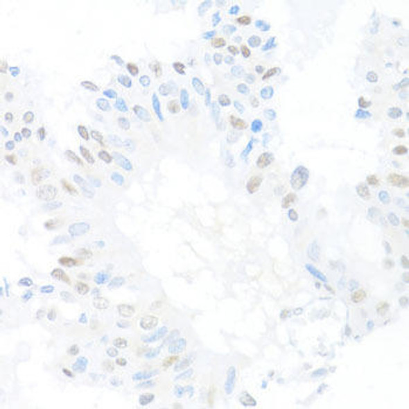 Anti-CREM Antibody (CAB5624)