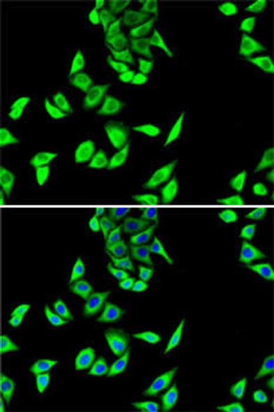 Anti-FH Antibody (CAB5688)