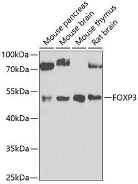 Anti-FOXP3 Antibody (CAB5706)