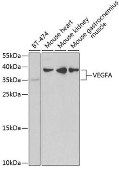 Anti-VEGFA Antibody (CAB5708)