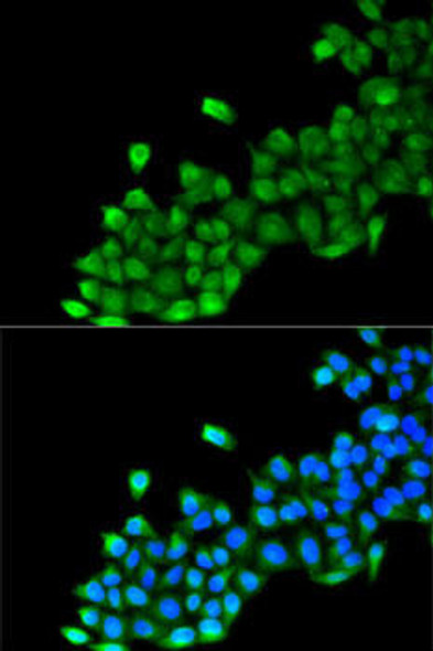 Anti-GC Antibody (CAB5709)