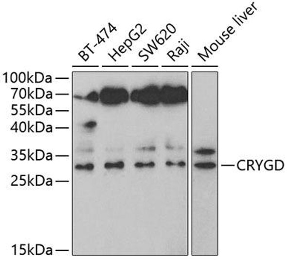 Anti-CRYGD Antibody (CAB5740)