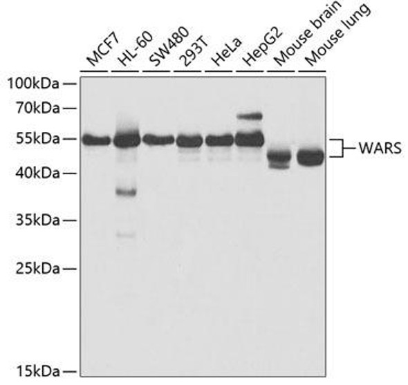 Anti-WARS Antibody (CAB5758)