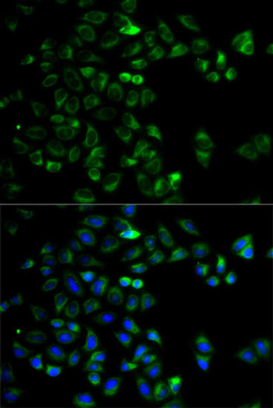 Anti-HTRA2 Antibody (CAB5762) Anti-HTRA2 Antibody (CAB5762)