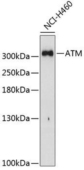 Anti-ATM Antibody (CAB5908)