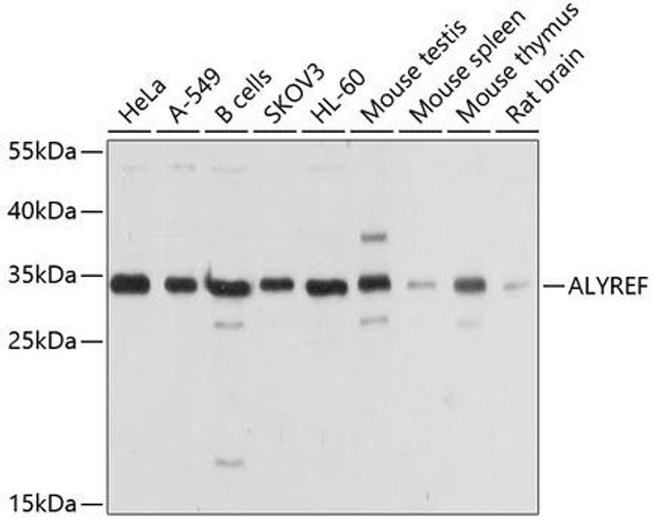 Anti-ALYREF Antibody (CAB6010)