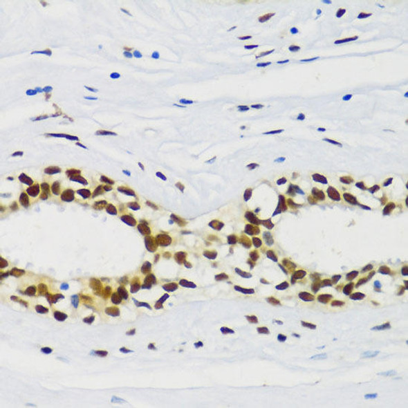 Anti-CIRBP Antibody (CAB6080)