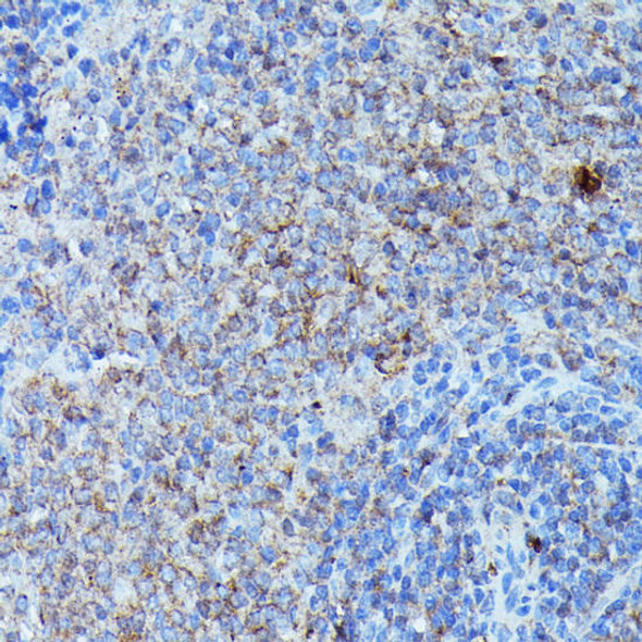 Anti-CSF3 Antibody (CAB6178)