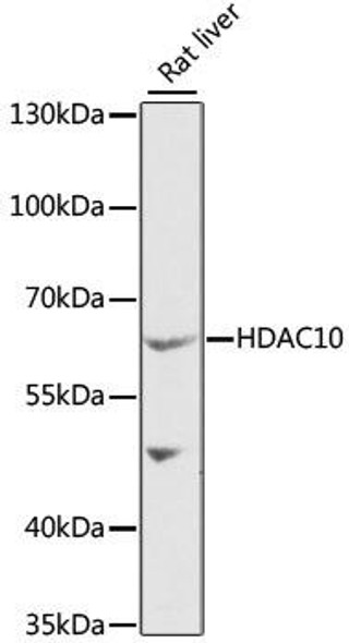 Anti-HDAC10 Antibody (CAB6184)