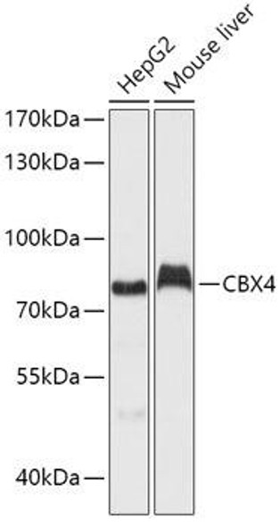 Anti-CBX4 Antibody (CAB6221)