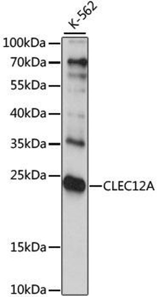 Anti-CLEC12A Antibody (CAB6250)