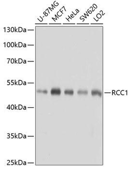 Anti-RCC1 Antibody (CAB6350)