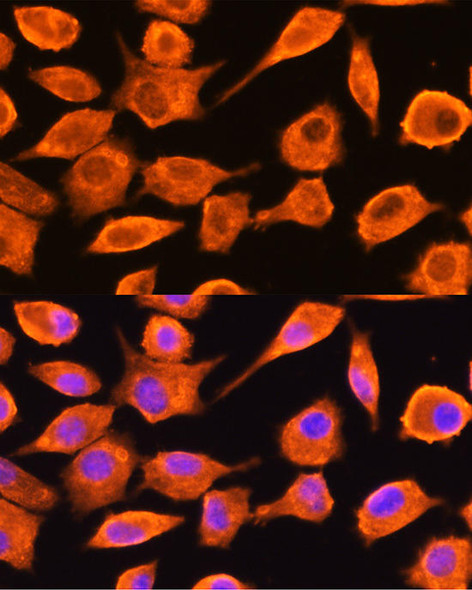 Anti-DTYMK Antibody (CAB6370)