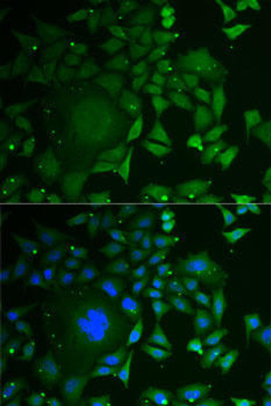 Anti-C1D Antibody (CAB6448)