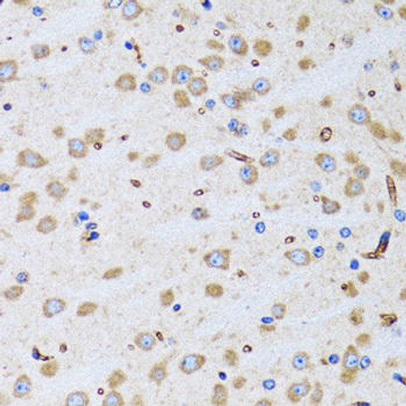 Anti-PTRH2 Antibody (CAB6466)