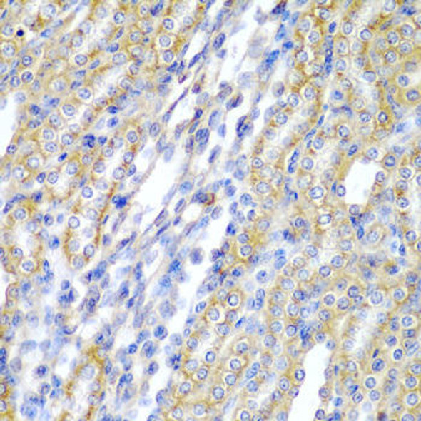 Anti-CYP20A1 Antibody (CAB6476)