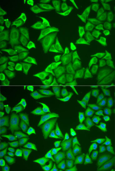Anti-NGB Antibody (CAB6477)