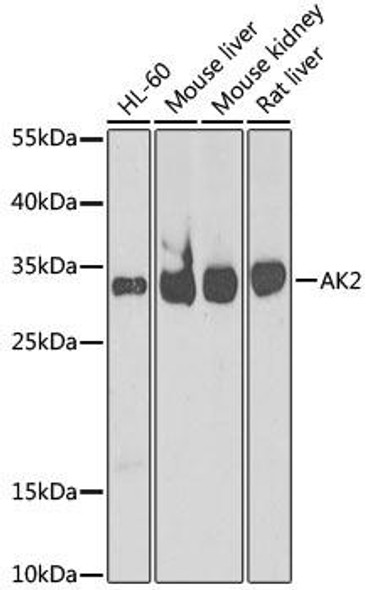 Anti-AK2 Antibody (CAB6519)[KO Validated]