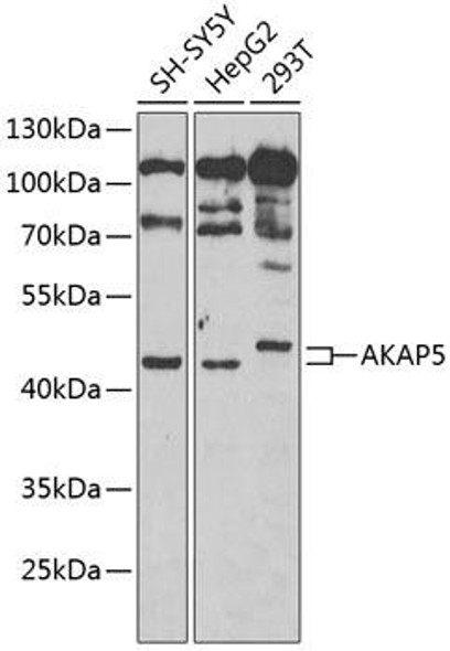 Anti-AKAP5 Antibody (CAB6520)