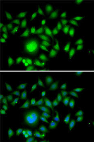 Anti-ATOH1 Antibody (CAB6530)