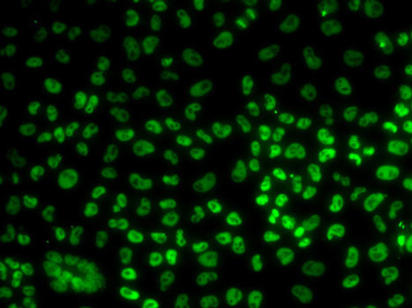 Anti-BUB3 Antibody (CAB6536)