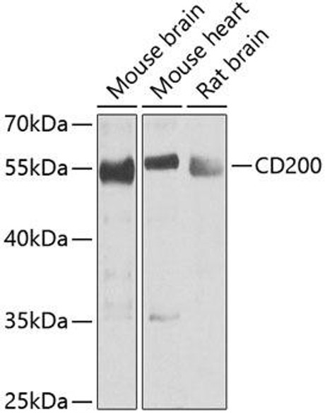 Anti-CD200 Antibody (CAB6552)