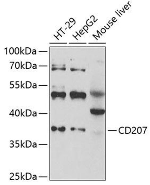 Anti-CD207 Antibody (CAB6553)
