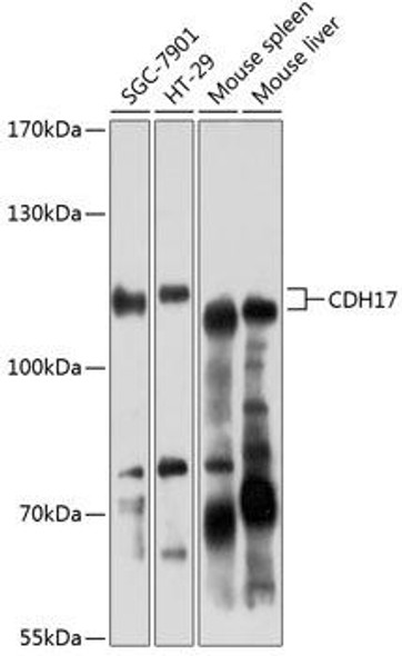 Anti-CDH17 Antibody (CAB6555)