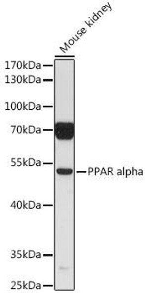 Anti-PPAR alpha Antibody (CAB6697)