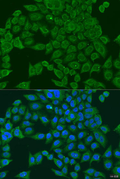 Anti-PIWIL-1 Antibody (CAB6823)