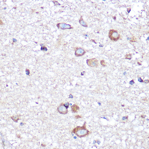 Anti-APLP1 Antibody (CAB6870)