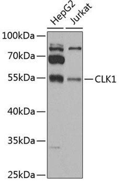 Anti-CLK1 Antibody (CAB6887)