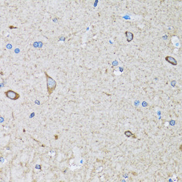 Anti-HIP1 Antibody (CAB6921)