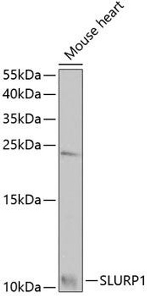 Anti-SLURP1 Antibody (CAB7123)