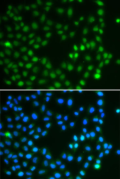 Anti-SALL4 Antibody (CAB7124)