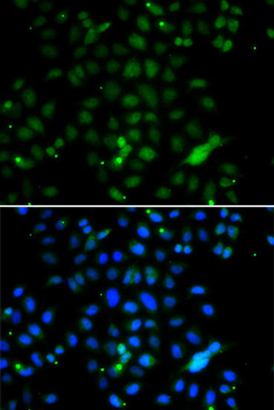 Anti-ELF4 Antibody (CAB7180)