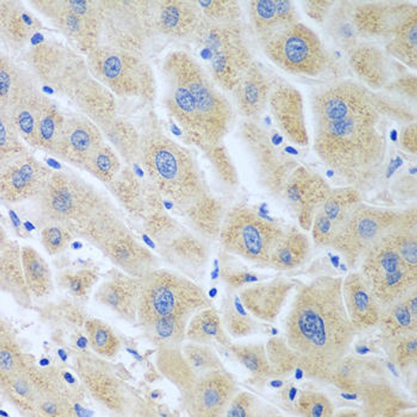 Anti-BLVRB Antibody (CAB7260)