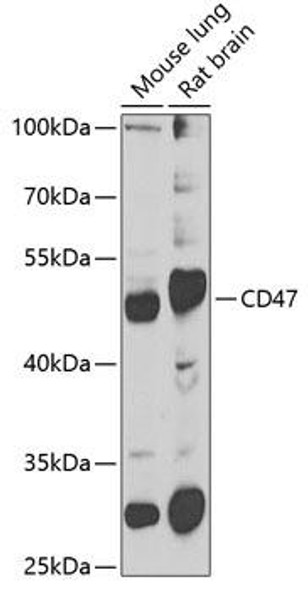 Anti-CD47 Antibody (CAB7278)