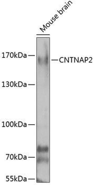 Anti-CNTNAP2 Antibody (CAB7466)