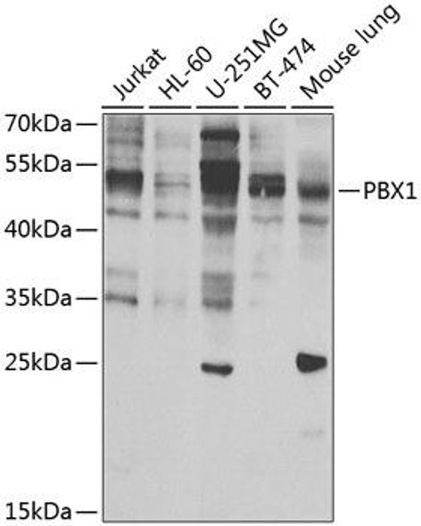 Anti-PBX1 Antibody (CAB7567)