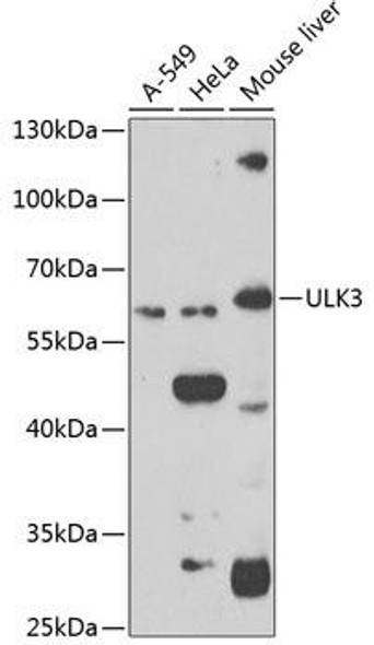 Anti-ULK3 Antibody (CAB7587)