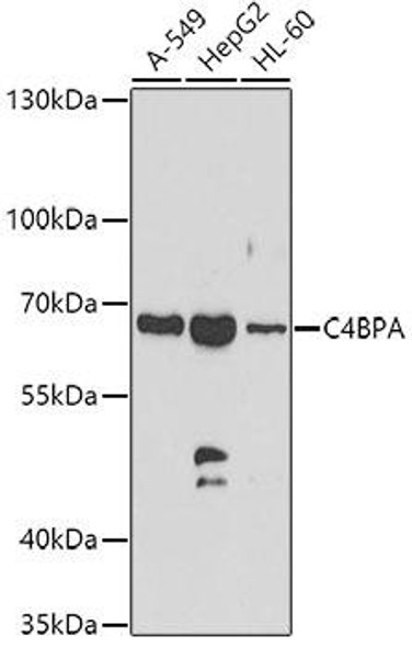 Anti-C4BPA Antibody (CAB7648)