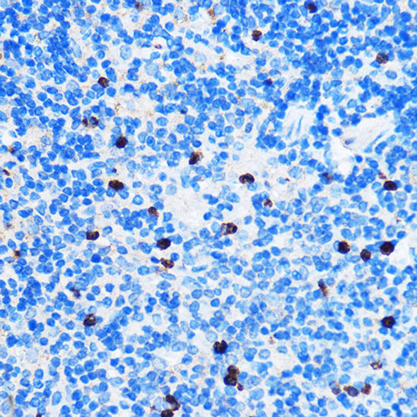 Anti-Chk1 Antibody (CAB7653)