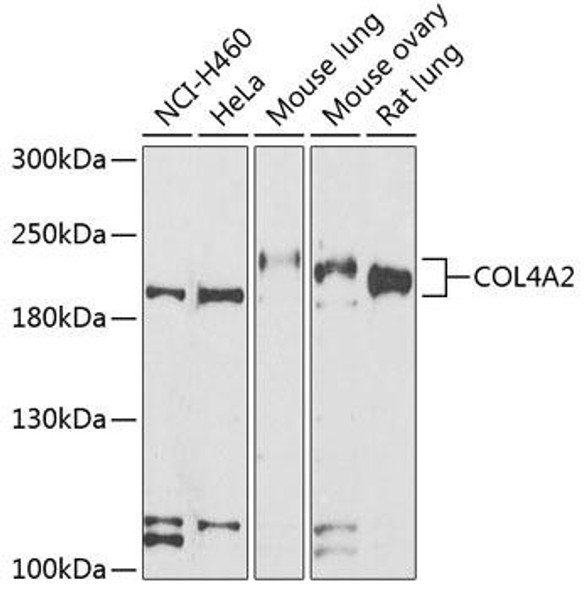 Anti-COL4A2 Antibody (CAB7657)