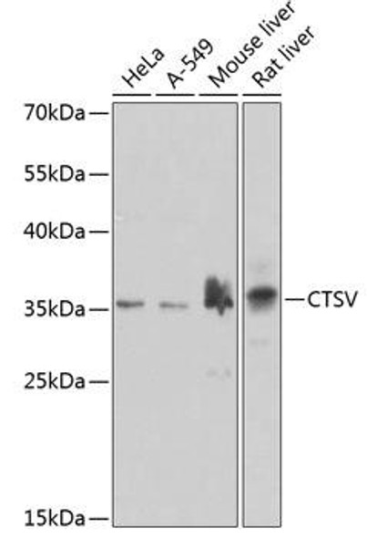 Anti-CTSV Antibody (CAB7662)