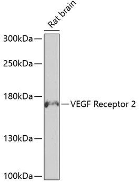 Anti-VEGF Receptor 2 Antibody (CAB7695)