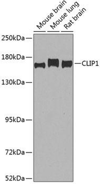 Anti-CLIP1 Antibody (CAB7722)