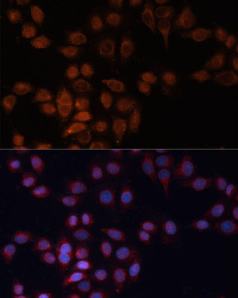 Anti-ADAM15 Antibody (CAB7756)