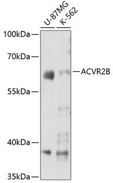 Anti-ACVR2B Antibody (CAB7868)