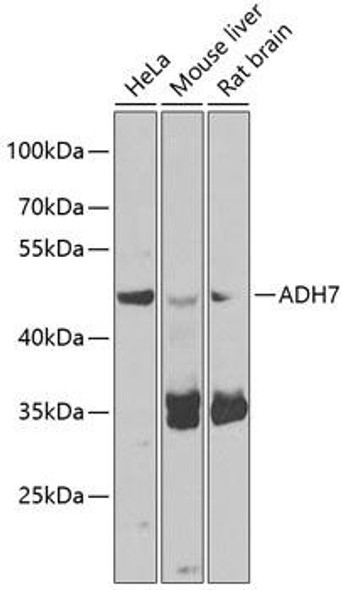 Anti-ADH7 Antibody (CAB7871)